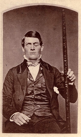 Phineas-Gage